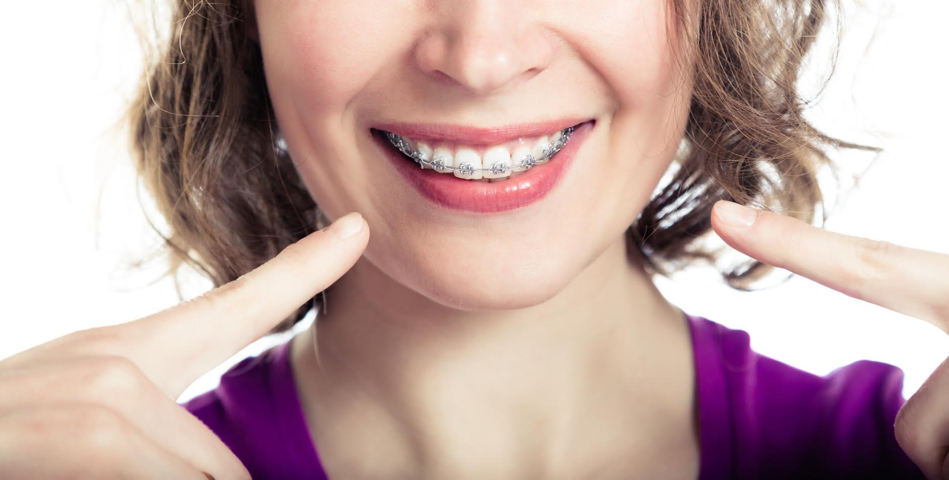 dental-white-ortodoncja-ortodonta-aparat-ortodontyczny