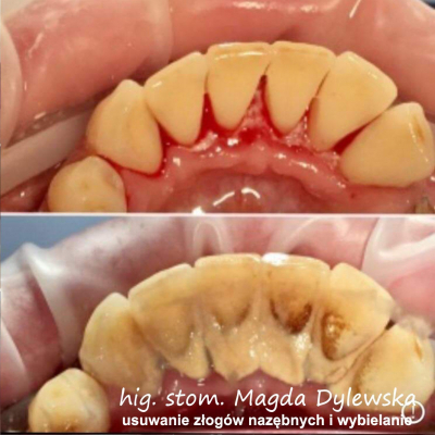 czyszczenie zębów Magda Dylewska 10