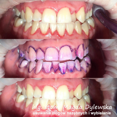 czyszczenie zębów Magda Dylewska 7