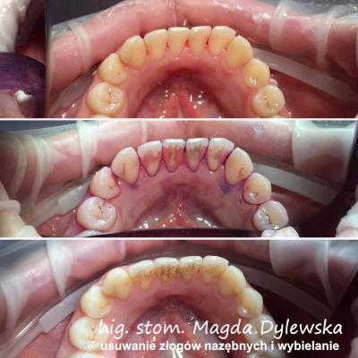 czyszczenie zębów Magda Dylewska 9