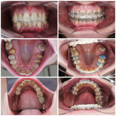 ortodoncja-DentalWhite-a