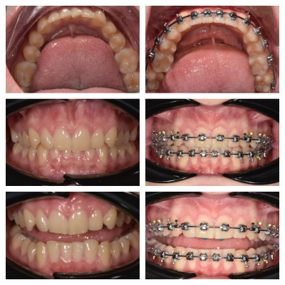 ortodoncja-DentalWhite-