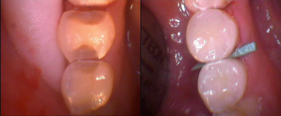 Stomatologia Zachowawcza